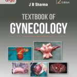 Textbook of Gynecology