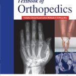 Textbook of Orthopedics