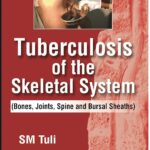 Tuberculosis of the Skeletal System (Bones, Joints, Spine and Bursal Sheaths)