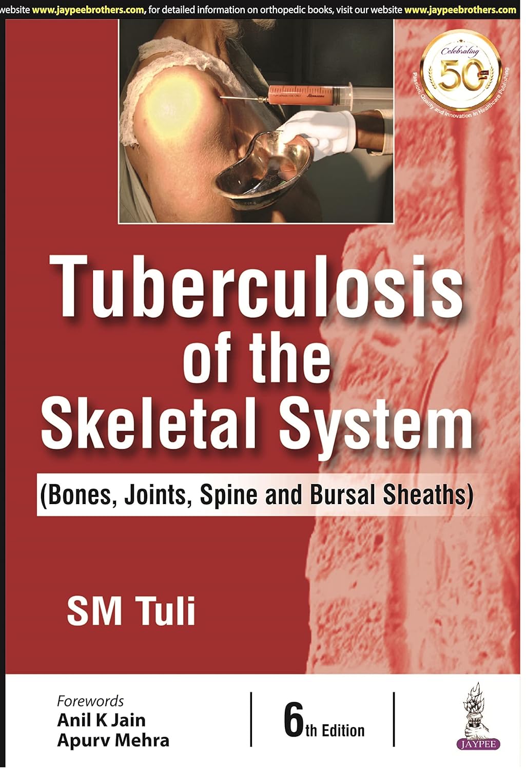 Tuberculosis of the Skeletal System (Bones, Joints, Spine and Bursal Sheaths) - Image 1