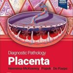 Diagnostic Pathology: Placenta
